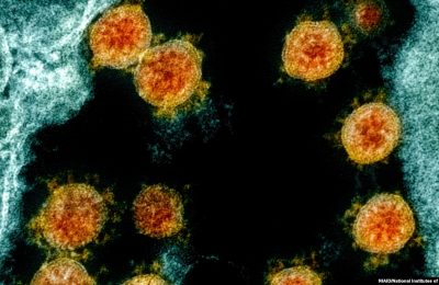 Partikel virus Novel Coronavirus SARS-CoV-2. Mutasi baru COVID-19 yang dinamakan B11529 ditemukan di wilayah Selatan Afrika. (Foto: NIAID/National Institutes of Health via AP)