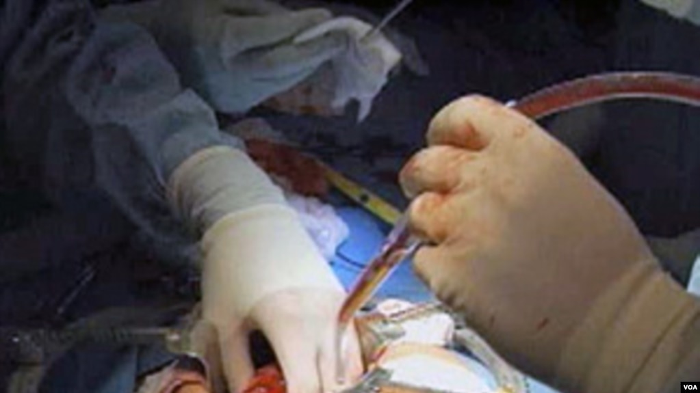 Ilustrasi - Seorang pasien yang gagal ginjal sedang menjalani transplantasi di sebuah rumah sakit di AS.