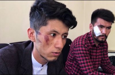 Dua jurnalis Afghanistan yang mengalami kekerasan oleh militan Taliban (foto: dok).