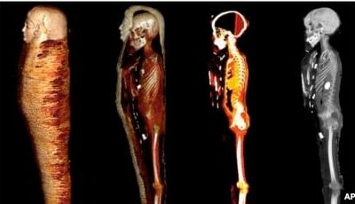 Lapisan mumi Mesir yang berasal dari 330 SM hasil pemindaian CT (computed tomography), dalam foto selebaran yang dirilis 24 Januari 2023. (Sahar N. Saleem via AP)